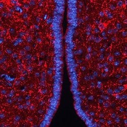 Invitrogen AgRP Polyclonal Antibody 100 &mu;g; Unconjugated:Antibodies,