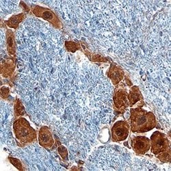Invitrogen GDF15 Polyclonal Antibody 100 &mu;g; Unconjugated:Antibodies,