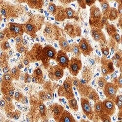 Invitrogen UGT1A1 Polyclonal Antibody 100 μg; Unconjugated:Antibodies,