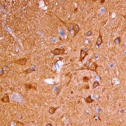 Invitrogen Neurocan Polyclonal Antibody 100 &mu;g | Buy Online | Invitrogen&trade; | Fisher Scientific