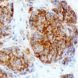 Invitrogen LY6K Polyclonal Antibody 100 &mu;g; Unconjugated:Antibodies,