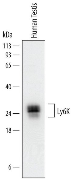 Invitrogen LY6K Polyclonal Antibody 100 &mu;g; Unconjugated:Antibodies,