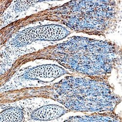 Invitrogen FGF15 Polyclonal Antibody 100 &mu;g | Buy Online | Invitrogen&trade; | Fisher Scientific