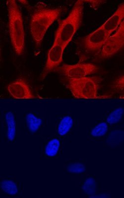 Invitrogen TMSB4X Polyclonal Antibody 100 &mu;g; Unconjugated:Antibodies,