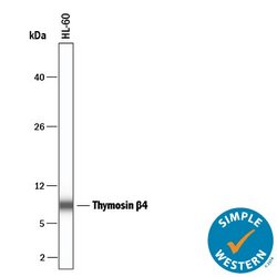 Invitrogen TMSB4X Polyclonal Antibody 100 &mu;g; Unconjugated:Antibodies,