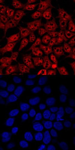 Invitrogen IRF2BP1 Polyclonal Antibody 100 &mu;g | Buy Online | Invitrogen&trade; | Fisher Scientific