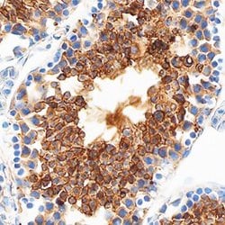 Invitrogen PRSS21 Polyclonal Antibody 100 &mu;g; Unconjugated:Antibodies,