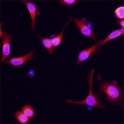 Invitrogen Dynactin 2 Polyclonal Antibody 100 &mu;g; Unconjugated:Antibodies,