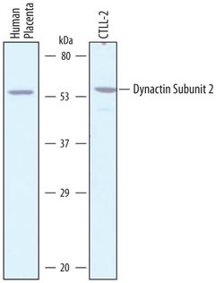 Invitrogen Dynactin 2 Polyclonal Antibody 100 &mu;g; Unconjugated:Antibodies,