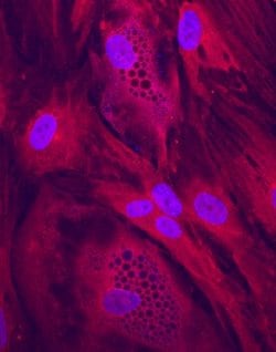 Invitrogen CLTCL1 Polyclonal Antibody 100 &mu;g; Unconjugated:Antibodies,