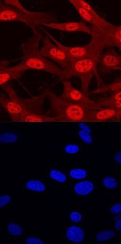 Invitrogen ARX Polyclonal Antibody 100 &mu;g | Buy Online | Invitrogen&trade; | Fisher Scientific