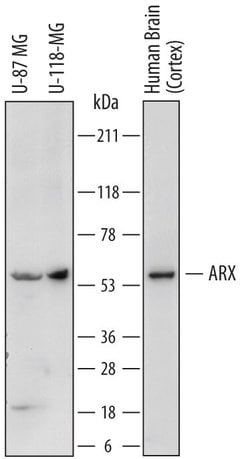 Invitrogen ARX Polyclonal Antibody 100 &mu;g | Buy Online | Invitrogen&trade; | Fisher Scientific