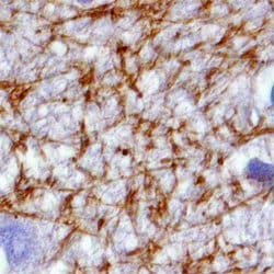 Invitrogen MAGI2 Polyclonal Antibody 100 &mu;g; Unconjugated:Antibodies,