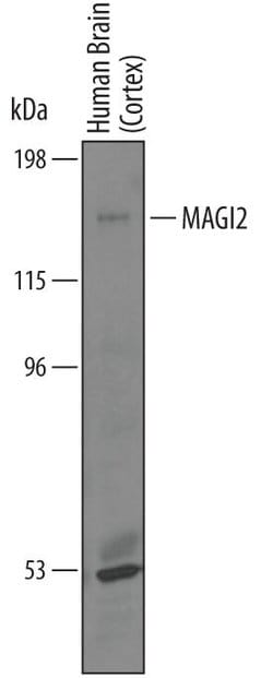Invitrogen MAGI2 Polyclonal Antibody 100 &mu;g; Unconjugated:Antibodies,