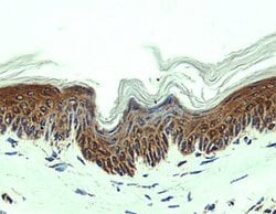 Invitrogen CCL27 Polyclonal Antibody 100 &mu;g; Unconjugated:Antibodies,
