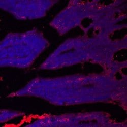 Invitrogen SLC39A4 Polyclonal Antibody 100 &mu;g | Buy Online | Invitrogen&trade; | Fisher Scientific