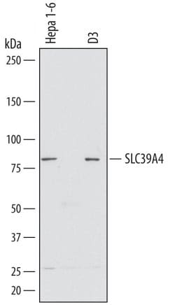 Invitrogen SLC39A4 Polyclonal Antibody 100 &mu;g | Buy Online | Invitrogen&trade; | Fisher Scientific