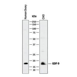 GDF9 Polyclonal Antibody, Invitrogen 100 &mu;g; Unconjugated:Anticuerpos