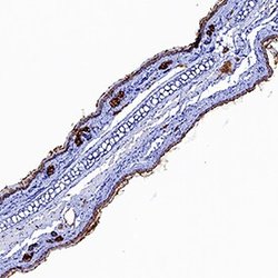 Invitrogen IL1R1 Polyclonal Antibody 100 &mu;g; Unconjugated:Antibodies,