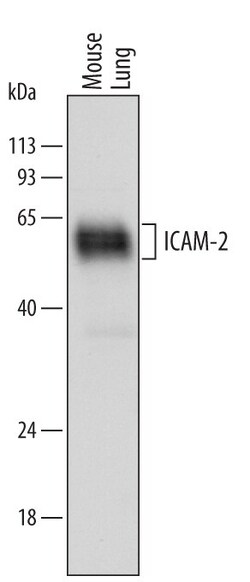 Invitrogen ICAM-2 Polyclonal Antibody 100 &mu;g | Buy Online | Invitrogen&trade; | Fisher Scientific