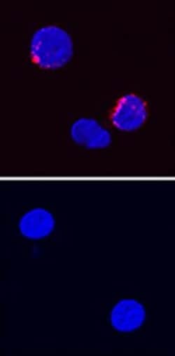 Invitrogen IFN gamma Polyclonal Antibody 100 &mu;g; Unconjugated:Antibodies,