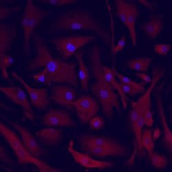 Invitrogen MIP-3 beta Polyclonal Antibody 100 &mu;g; Unconjugated:Antibodies,