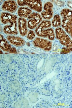 Invitrogen ACE Polyclonal Antibody 100 &mu;g; Unconjugated:Antibodies,