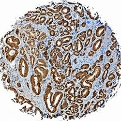 Invitrogen ADAM15 Polyclonal Antibody 100 &mu;g; Unconjugated:Antibodies,