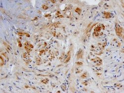 BMP-3 Polyclonal Antibody:Antibodies, Polyclonal