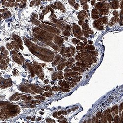 Invitrogen FGF16 Polyclonal Antibody 100 &mu;g; Unconjugated:Antibodies,