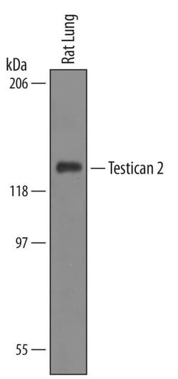 Invitrogen SPOCK2 Polyclonal Antibody 100 &mu;g; Unconjugated:Antibodies,