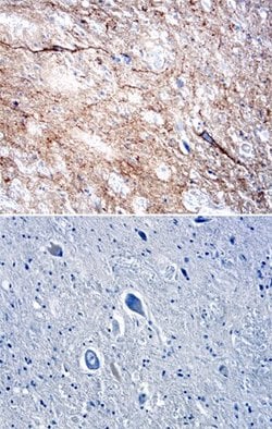 Invitrogen DPP6 Polyclonal Antibody 100 &mu;g; Unconjugated:Antibodies,