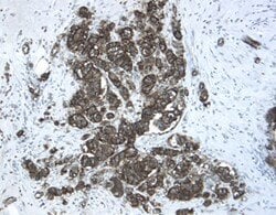 Invitrogen CHRDL2 Polyclonal Antibody 100 &mu;g; Unconjugated:Antibodies,