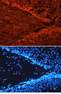 Invitrogen SorCS3 Polyclonal Antibody 100 &mu;g; Unconjugated:Antibodies,