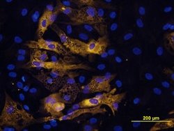 Invitrogen Adiponectin Polyclonal Antibody 100 &mu;g; Unconjugated:Antibodies,
