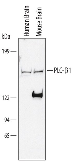 Invitrogen PLCB1 Polyclonal Antibody 100 &mu;g; Unconjugated:Antibodies,