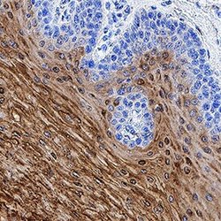 Invitrogen TGM3 Polyclonal Antibody 100 &mu;g; Unconjugated:Antibodies,