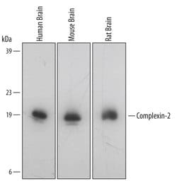 Invitrogen CPLX2 Polyclonal Antibody 100 &mu;g; Unconjugated:Antibodies,