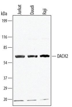 Invitrogen DACH2 Polyclonal Antibody 100 &mu;g; Unconjugated:Antibodies,
