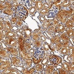 Invitrogen USP2 Polyclonal Antibody 100 &mu;g; Unconjugated:Antibodies,