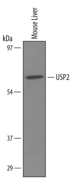 Invitrogen USP2 Polyclonal Antibody 100 &mu;g; Unconjugated:Antibodies,