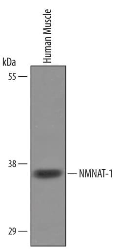Invitrogen NMNAT1 Polyclonal Antibody 100 &mu;g; Unconjugated:Antibodies,