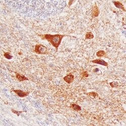 Invitrogen VWC2 Polyclonal Antibody 100 &mu;g; Unconjugated:Antibodies,