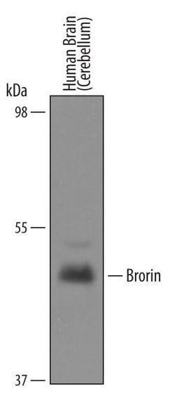 Invitrogen VWC2 Polyclonal Antibody 100 &mu;g; Unconjugated:Antibodies,
