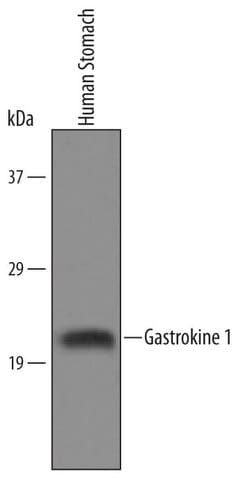 Invitrogen GKN1 Polyclonal Antibody 100 &mu;g; Unconjugated:Antibodies,