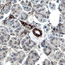 Invitrogen Phospho-MSK2 (Ser196) Polyclonal Antibody 100 &mu;g; Unconjugated:Antibodies,