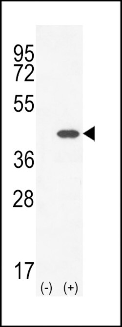 Invitrogen CLEC11A Polyclonal Antibody 400 &mu;L; Unconjugated:Antibodies,