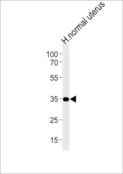 Invitrogen CUZD1 Polyclonal Antibody 400 &mu;L; Unconjugated:Antibodies,