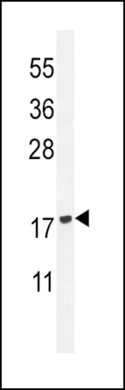 Invitrogen PLA2G2D Polyclonal Antibody 400 &mu;L; Unconjugated:Antibodies,