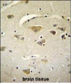 Invitrogen VSTM2A Polyclonal Antibody 400 &mu;L; Unconjugated:Antibodies,
